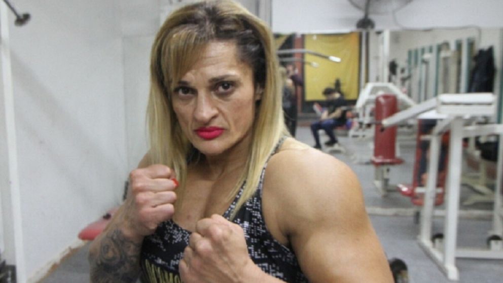 Le realizaron una traqueotomía a Alejandra “Locomotora” Oliveras y continúa con pronóstico reservado.