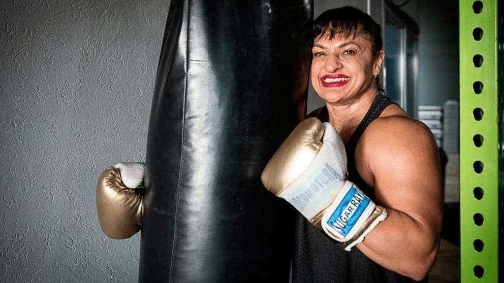 El ACV afectó el hemisferio izquierdo, que controla la movilidad del lado derecho del cuerpo.