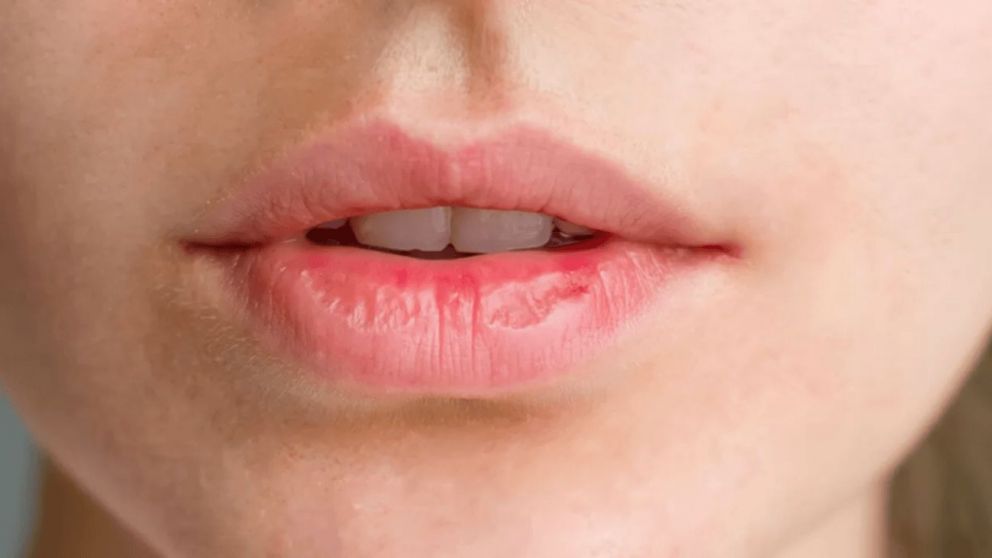 El truco sencillo para evitar los labios resecos y protegerlos durante el invierno.