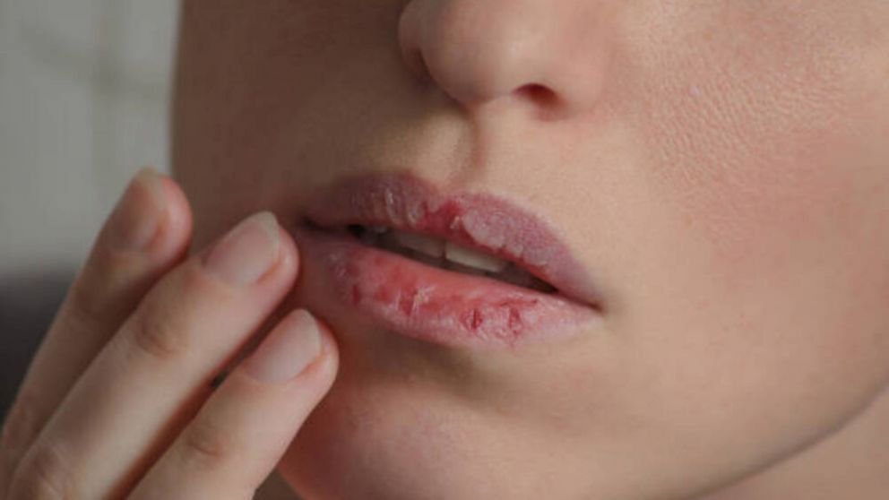 Qué productos son necesarios para mejorar los labios secos en invierno.