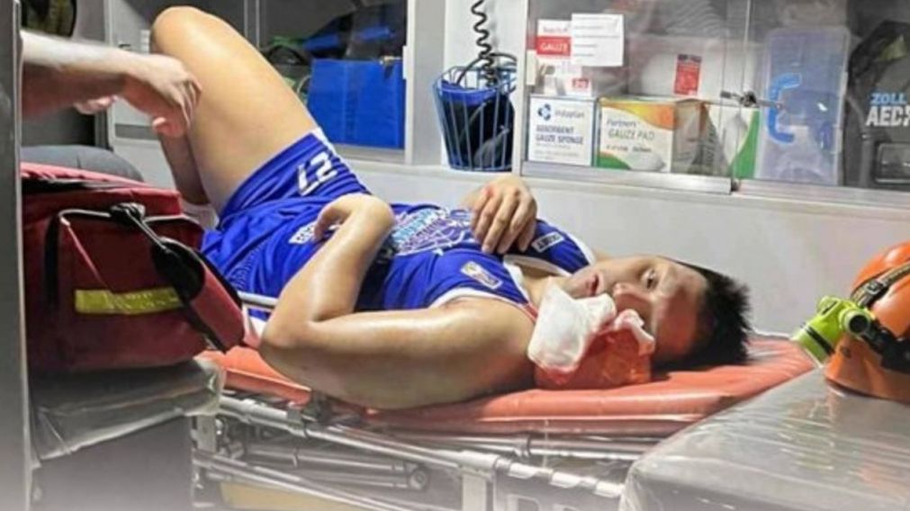 Tremenda agresión en el básquet de Filipinas: le pegó una trompada a su rival y le produjo una conmoción cerebral