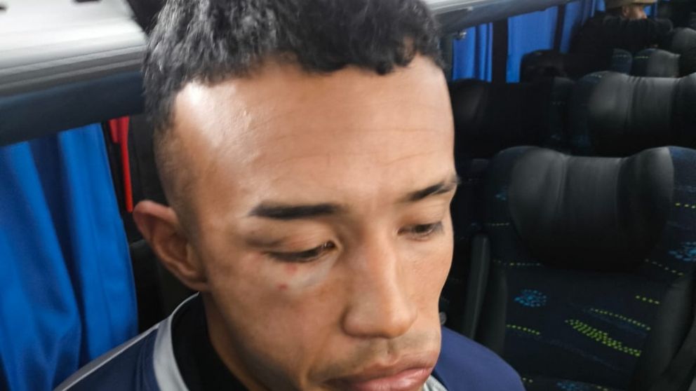 Perdón, diego: la pelota se manchó en el ascenso