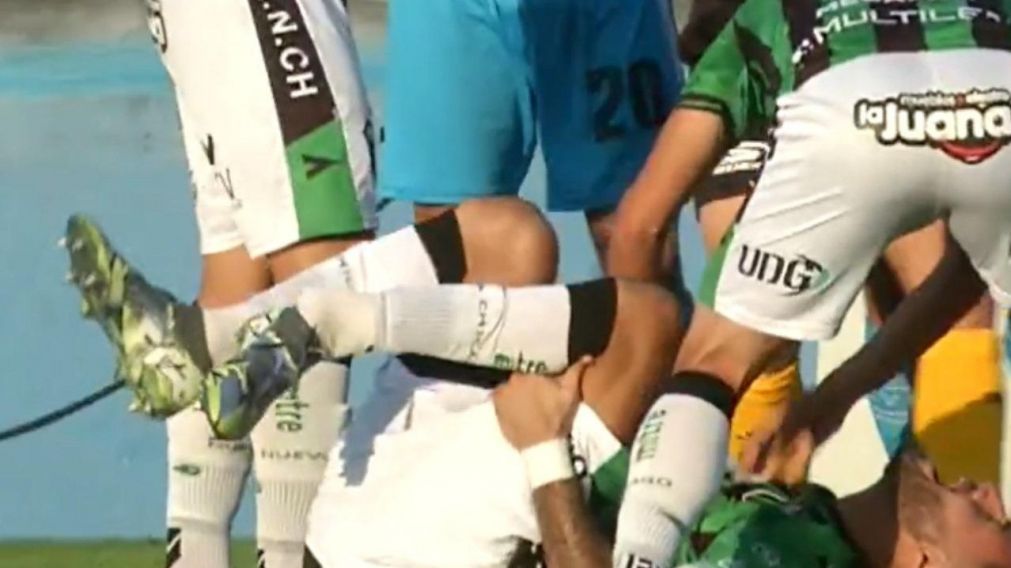 La tremenda sanción a un futbolista de Gimnasia de Jujuy que rompió a uno de Nueva Chicago: la espeluznante patada