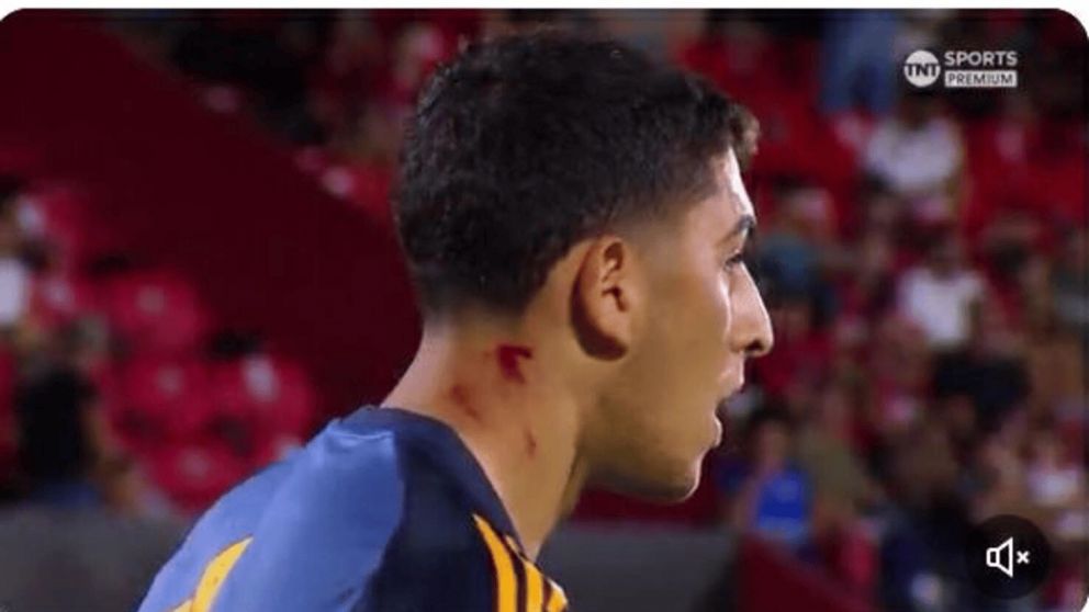 Los hinchas de Newell's instalaron un clima de guerra con los jugadores de Boca: el arquero Leandro Brey sufrió un duro corte