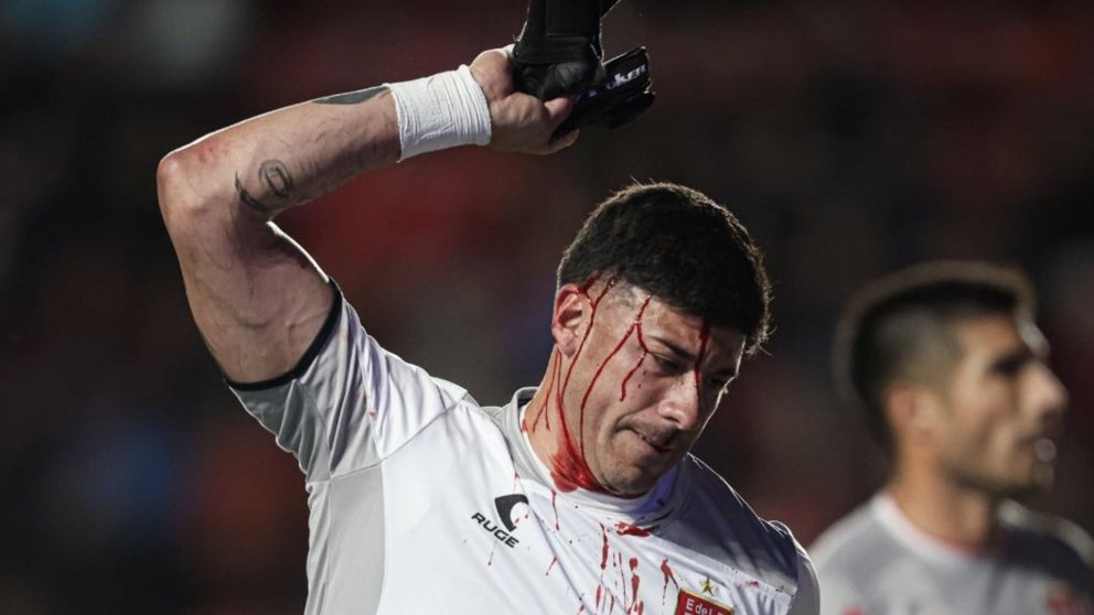 Video: el tremendo planchazo de un jugador de San Lorenzo en la cabeza al arquero de Estudiantes