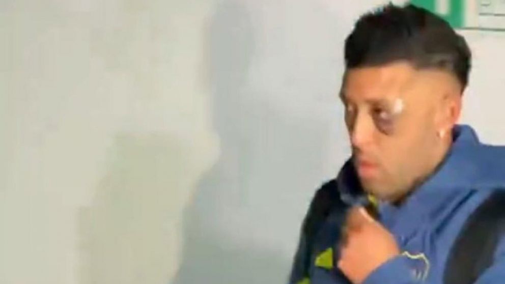 Polémica en Boca: por qué Lucas Janson apareció con el ojo morado tras salir del vestuario en la derrota ante Racing