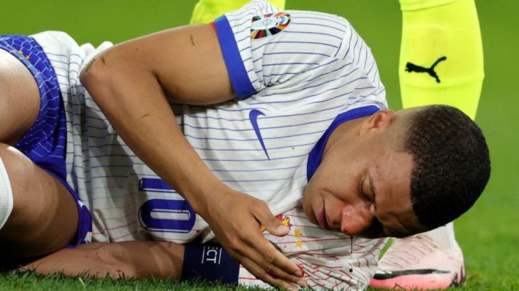 MALAS NOTICIAS para Francia: Deschamps dijo que Mbapp� "tendr� que operarse"