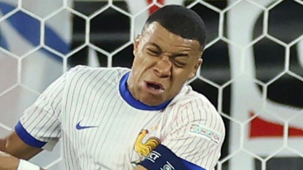 TREMENDO golpe: Kylian Mbappé se ROMPIÓ la nariz y ¿se queda AFUERA de la Eurocopa?