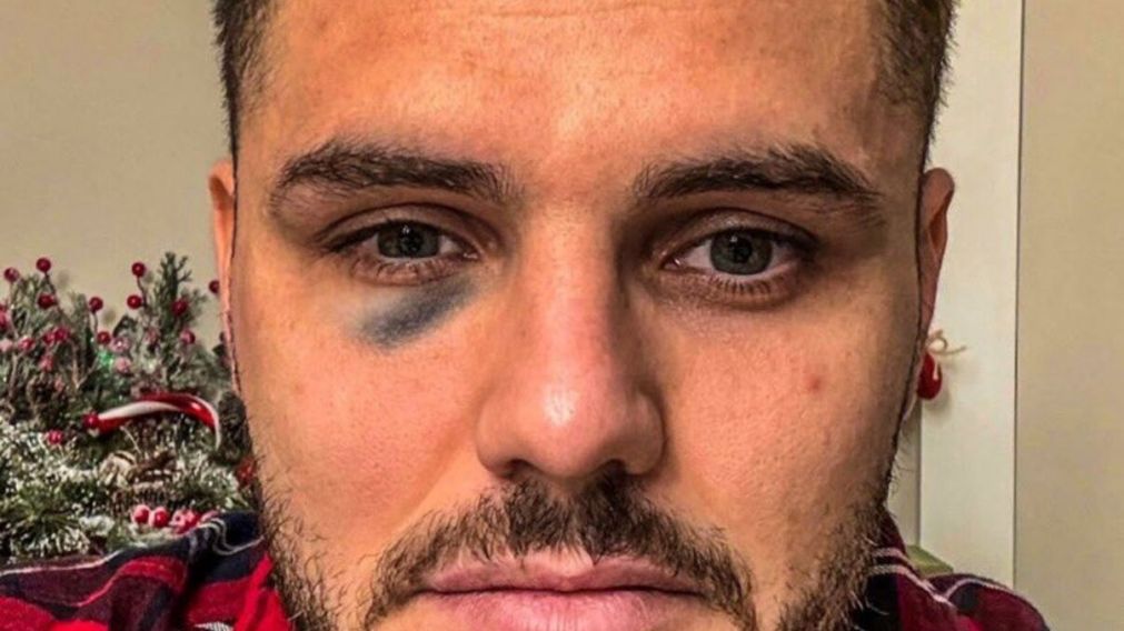 Mauro Icardi se peleó con un rival en el clásico entre Fenerbahce y Galatasaray