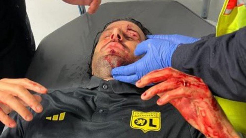 Violencia en Francia: hinchas del Marsella apedrearon el micro del Lyon, hirieron a su técnico y el partido fue suspendido