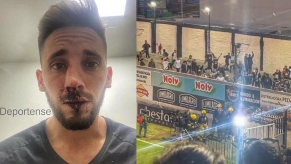 Hinchas de Estudiantes agredieron a allegados de Chacarita y la ligó Nico Morgantini, jugador de Platense