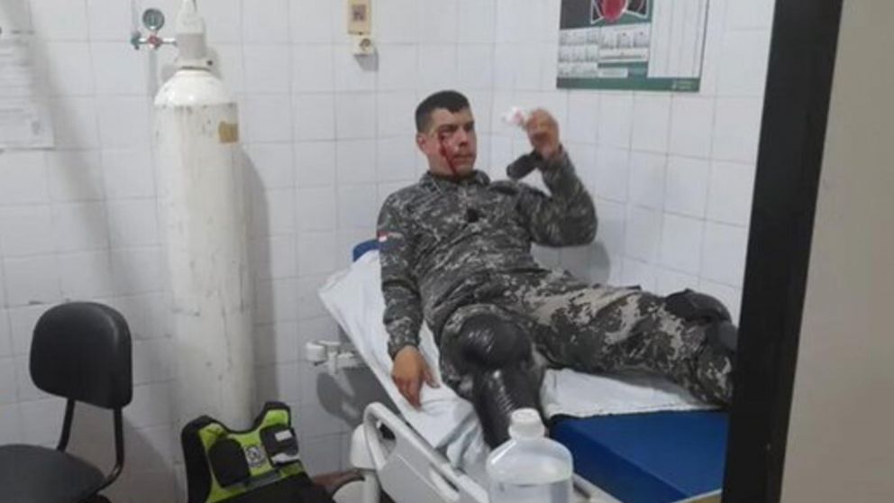 ¡Escándalo en Paraguay!: barras de Olimpia agredieron violentamente a la policía y uno casi pierde el ojo