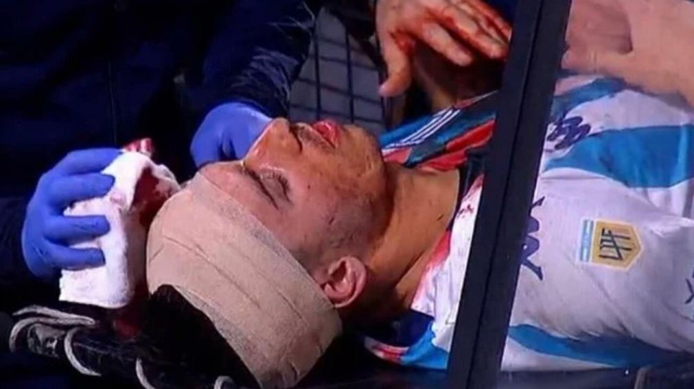 Facundo Mura, enojadísimo, repartió bombas para los jugadores de Boca y para el árbitro Andrés Merlos