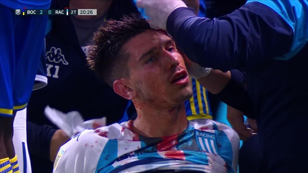 Los árbitros de Boca - Racing dieron insólitas explicaciones de por qué no expulsaron a los futbolistas Xeneizes