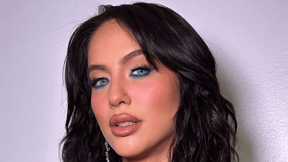 Flor Vigna. (Foto: Instagram/ @florvigna).