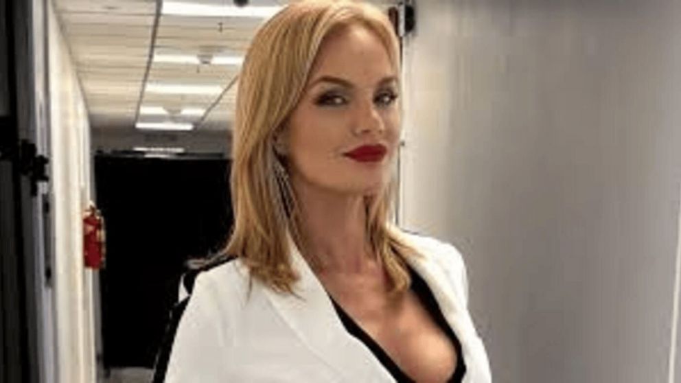 Eliana Guercio alertó sobre los riesgos de un retoque estético: Por favor investiguen antes de tocarse la cara con cualquiera