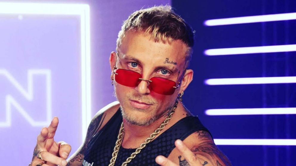 El Polaco brind� detalles del grave accidente que protagoniz�. (Foto: Instagram/ @elpolaco).