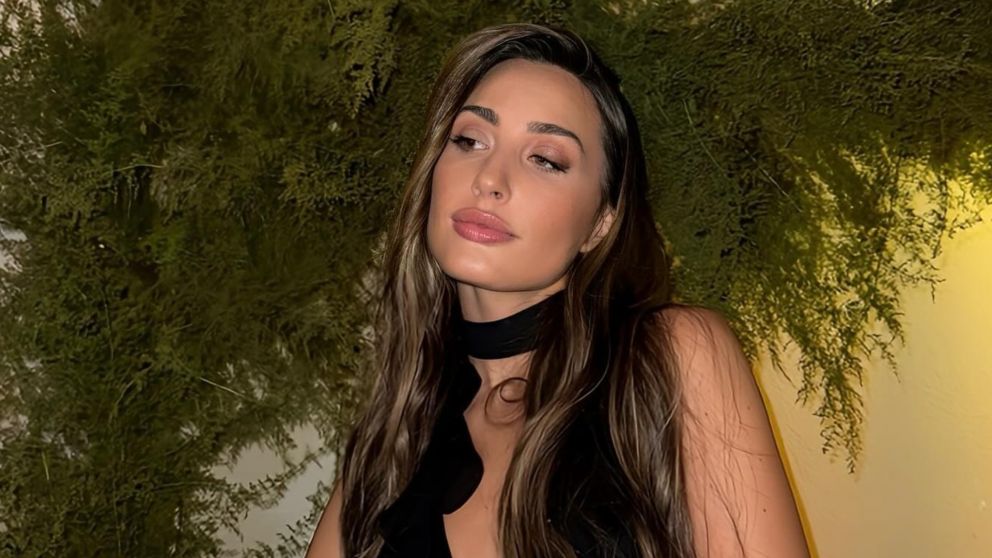 Yoyi, la hija de Guillermo Francella, sufrió un peligroso accidente doméstico y temió por su vida: "Algo del cuerpo no funcionó...". (Foto: Instagram/@yoyifrancella).