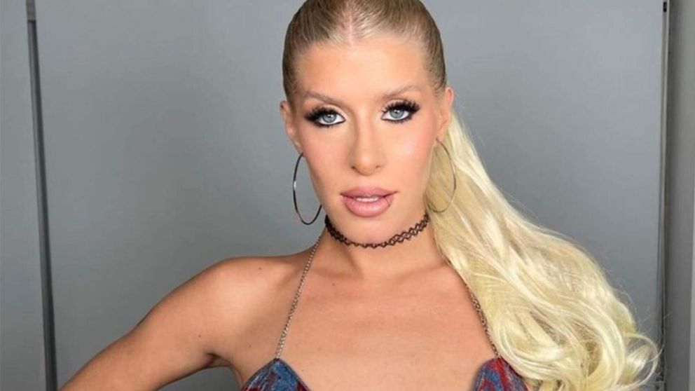 Camila Lattanzio, ex "Gran Hermano", sufrió un grave accidente de tránsito.