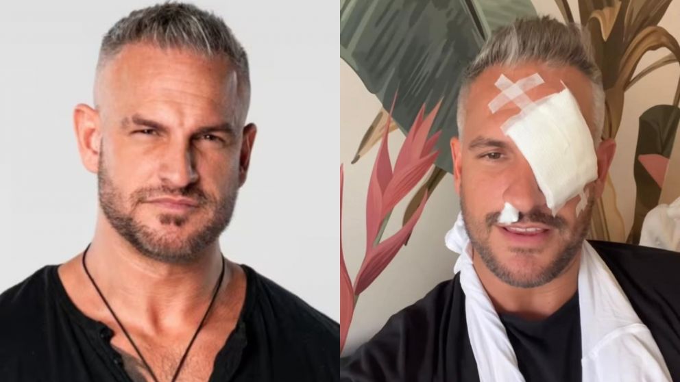 Tras su operación, Claudio de "Gran Hermano 2025" reapareció en redes y generó preocupación por su salud. (Foto: Telefe e Instagram/ @klaudiodl).