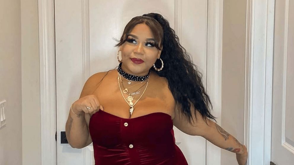 De qué murió la influencer Carol Acosta, a los 27 años. (Foto: Instagram/ @killadamente).
