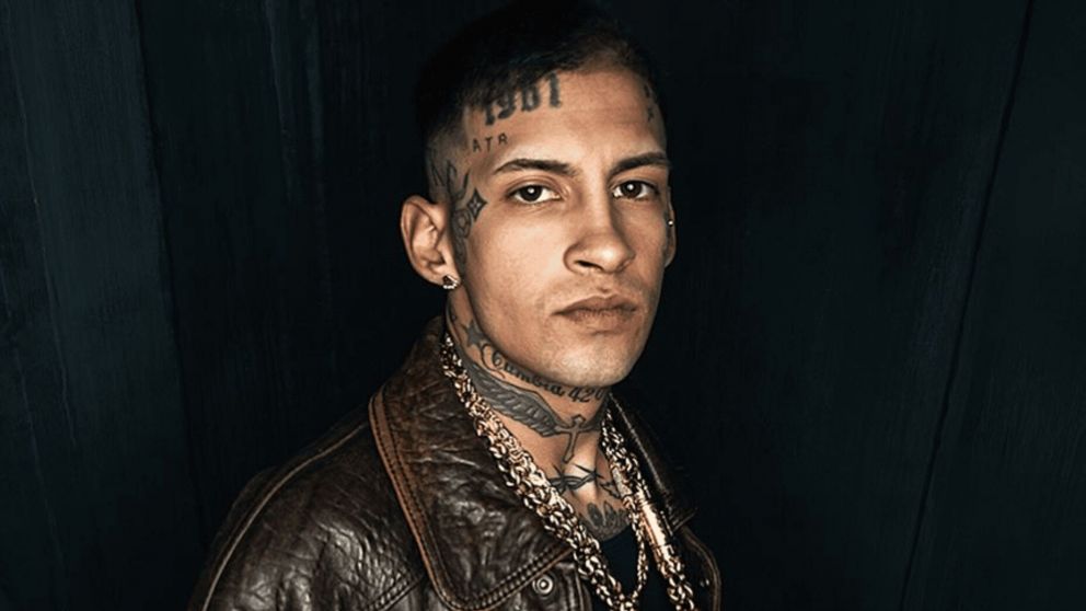 L-Gante sorprendió con su nueva dentadura.