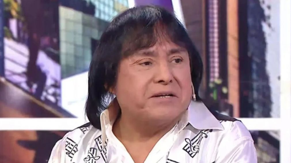 Ricky Maravilla reapareci� tras someterse a un retoque est�tico en la cara y gener� sorpresa en las redes. (web)