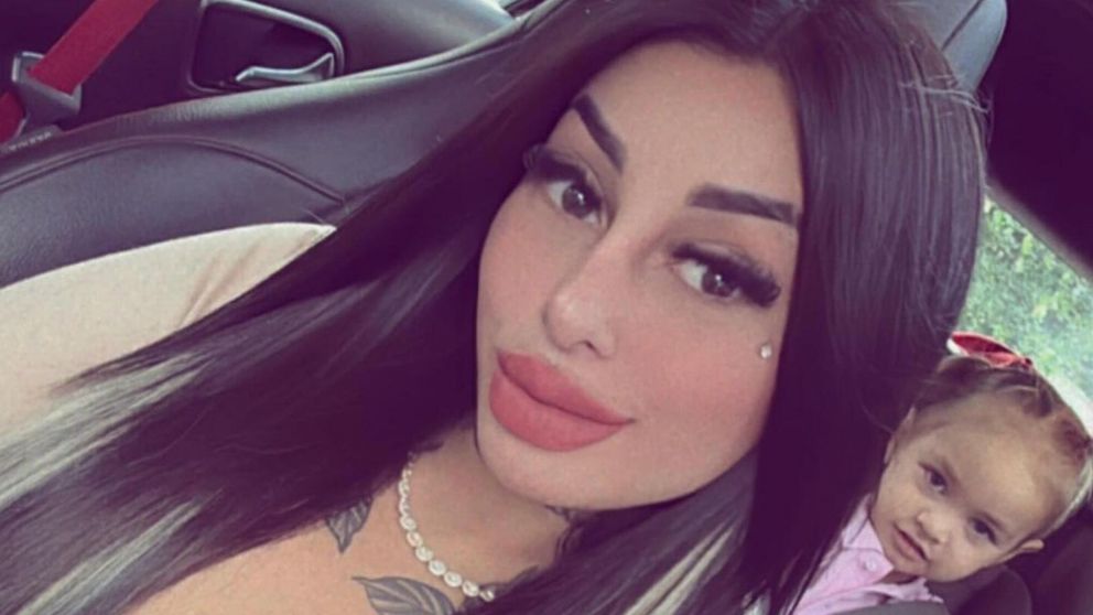 Tamara B�ez, la ex de L-Gante, se hizo una cirug�a est�tica que perjudic� a su hija.