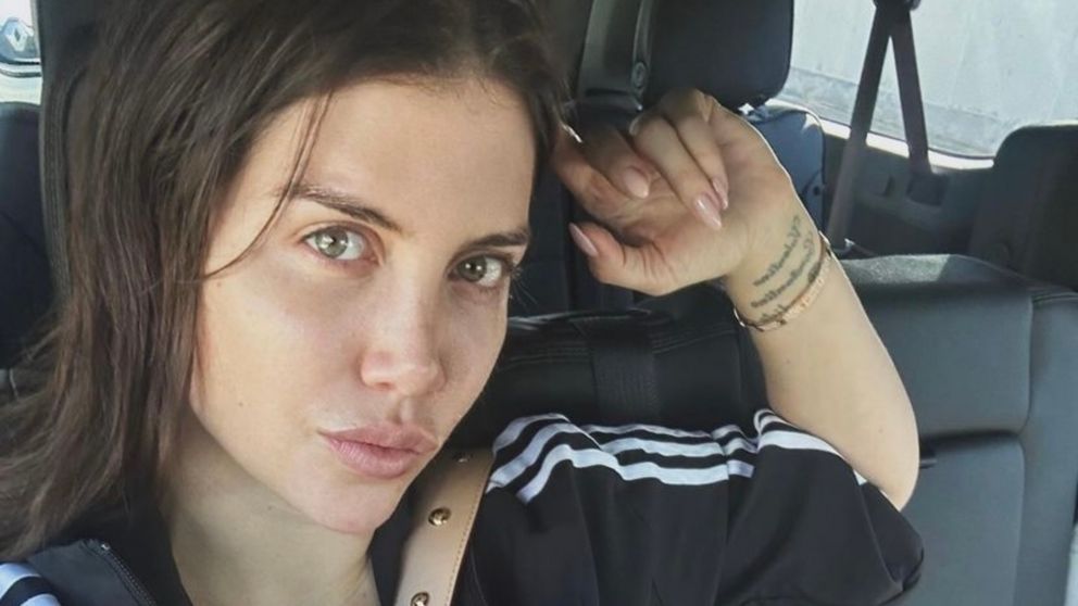 Wanda Nara se sometió a un misterioso tratamiento tras su delicado estado de salud. (Foto: Instagram/ @wanda_nara).