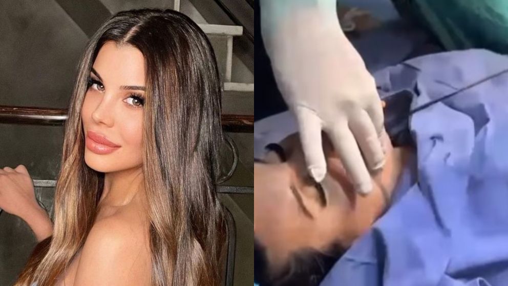 Charlotte Caniggia comparti� un video en plena cirug�a est�tica y gener� el repudio del p�blico.