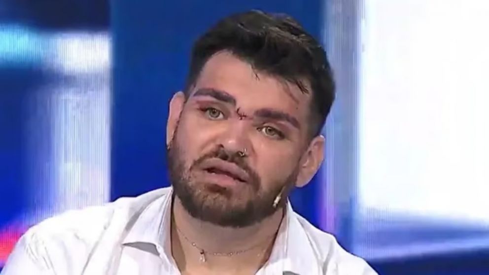 Fran Mariano internado de urgencia y genera preocupación.