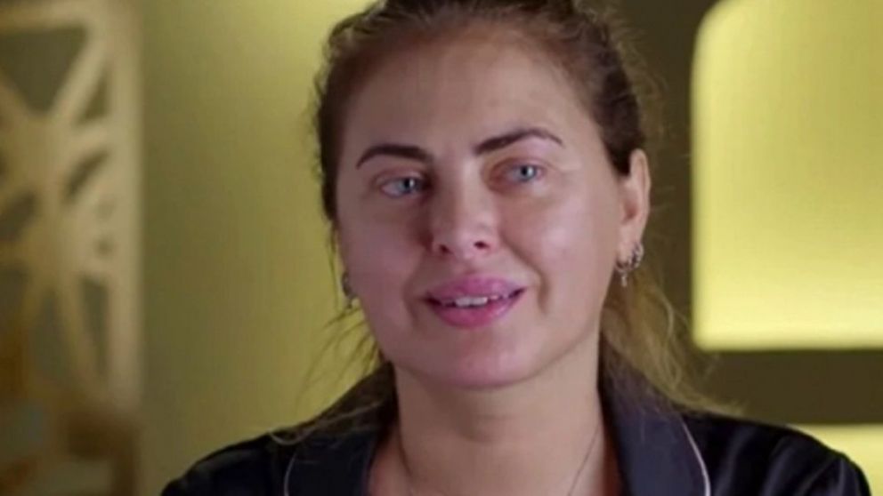 Luna se encuentra en espera para recibir un trasplante de ri��n.