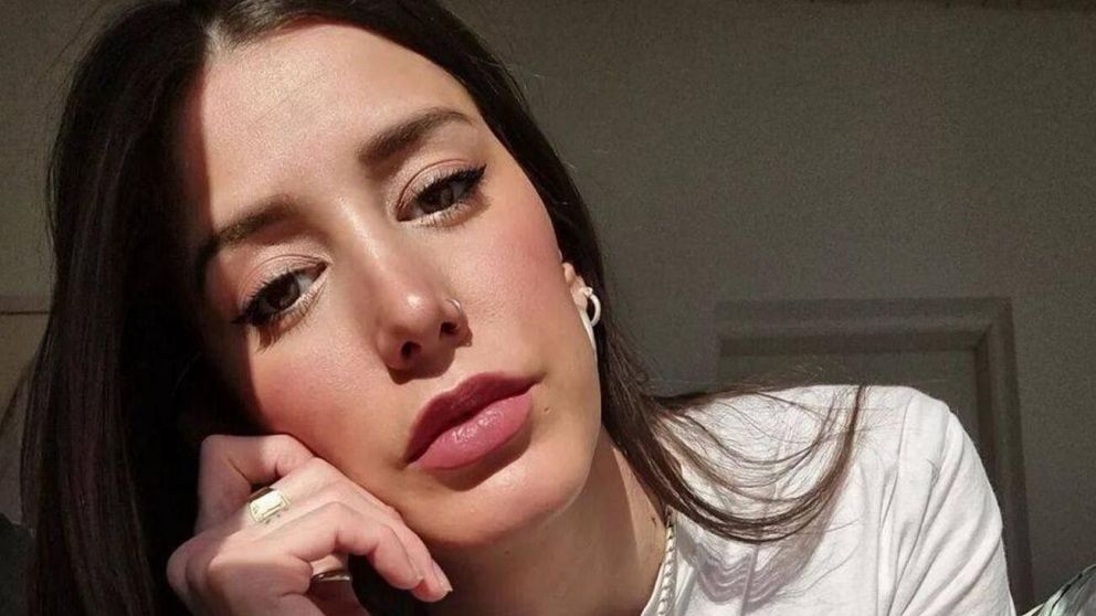 Las operaciones que se realizó Juliana de "Gran Hermano".