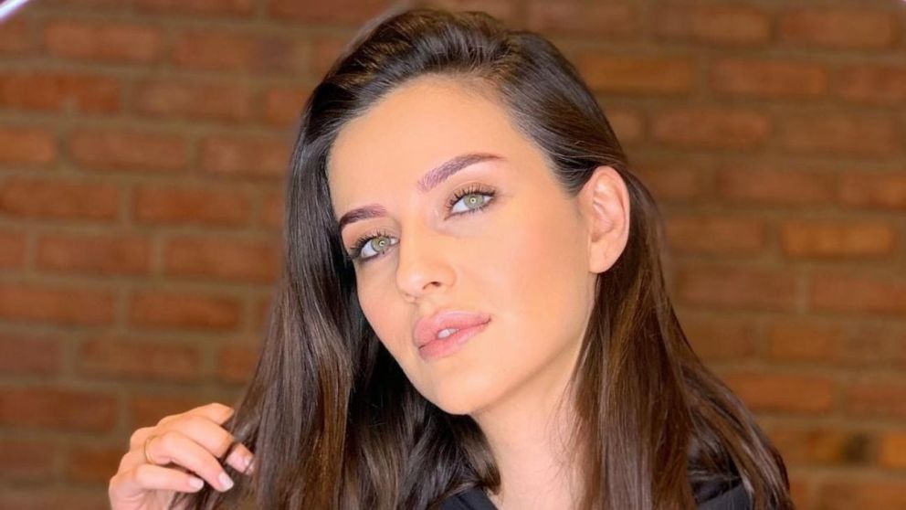 El cambio que tuvo Irem Helvacolu tras una operación.