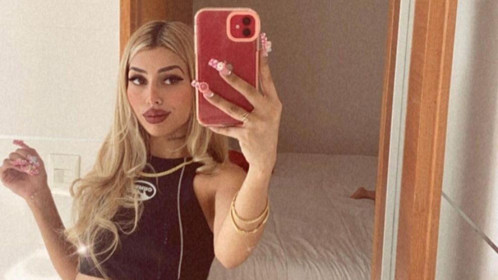 Tamara Báez, la novia de L-Gante, sufrió un duro accidente en Europa.