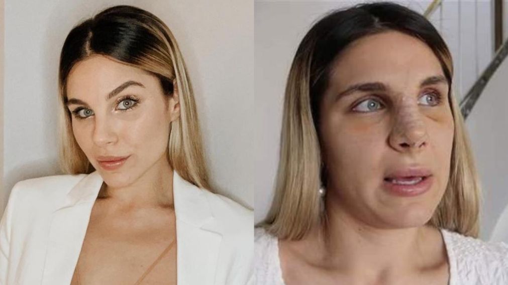 Ivana Icardi se sometió a una dolorosa operación.