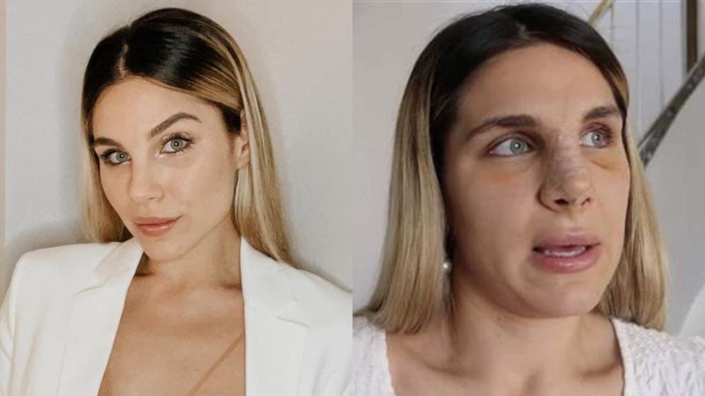 Ivana Icardi se sometió a una dolorosa operación.