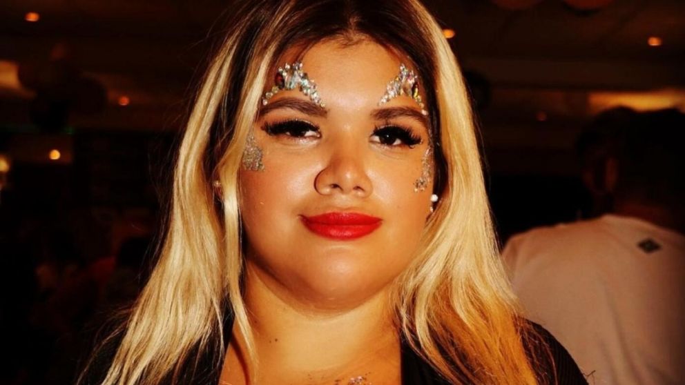 More Rial se someti� a una cirug�a pl�stica y lo mostr� en sus redes sociales.