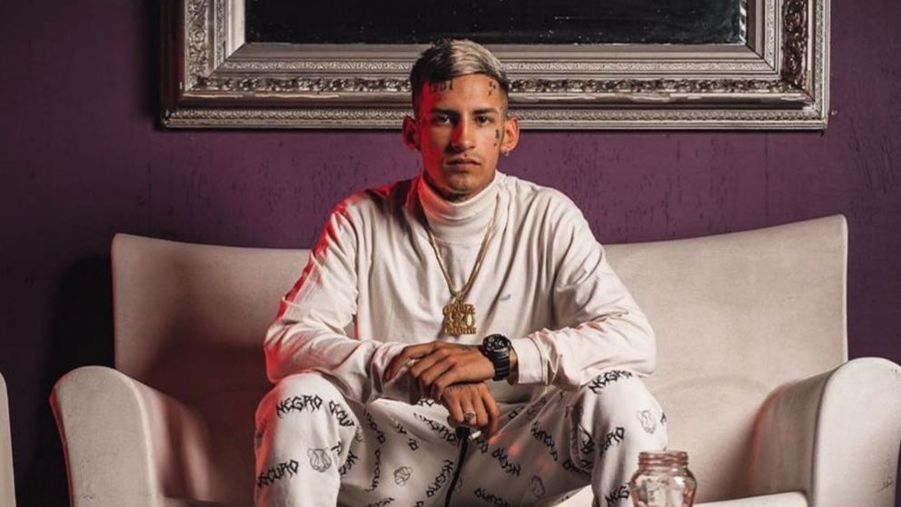 L-Gante contó que nunca se haría un retoque en la cara.