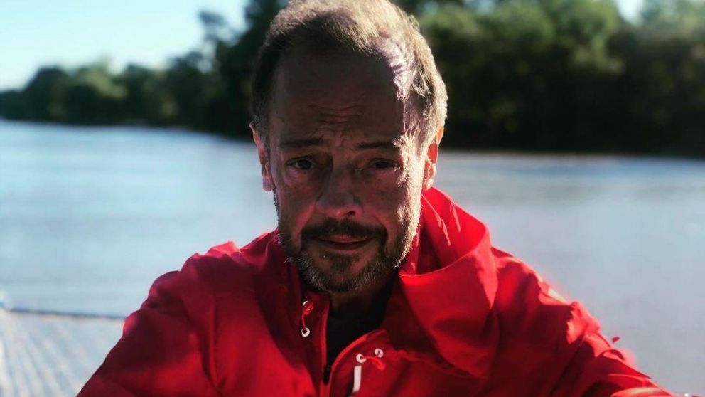 El conductor radial mostró una leve mejoría.