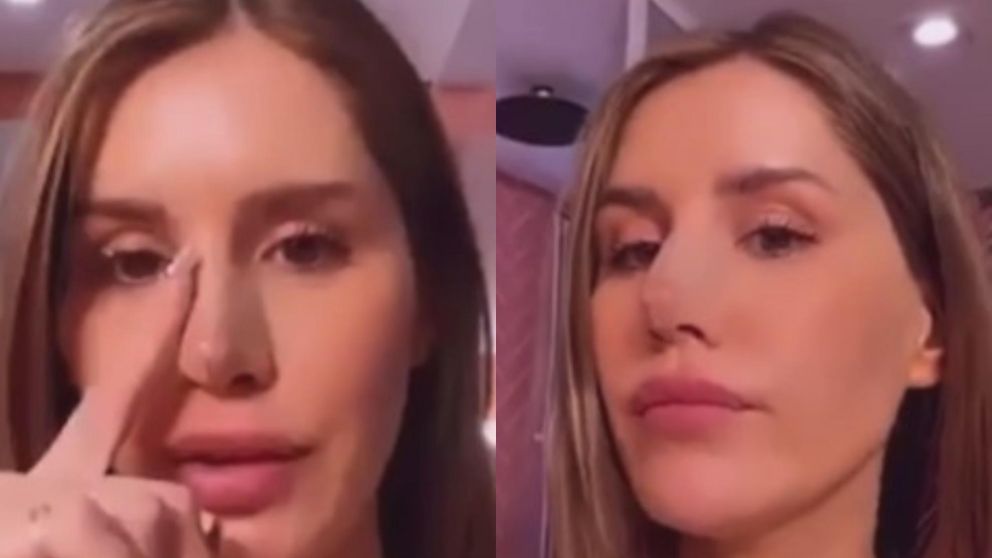 Una cirug�a problem�tica.