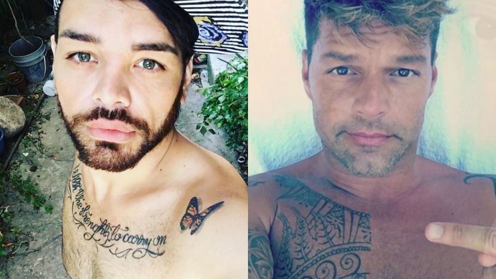 El ex "Cuestión de Peso" pasó por el quirófano más de 25 veces.