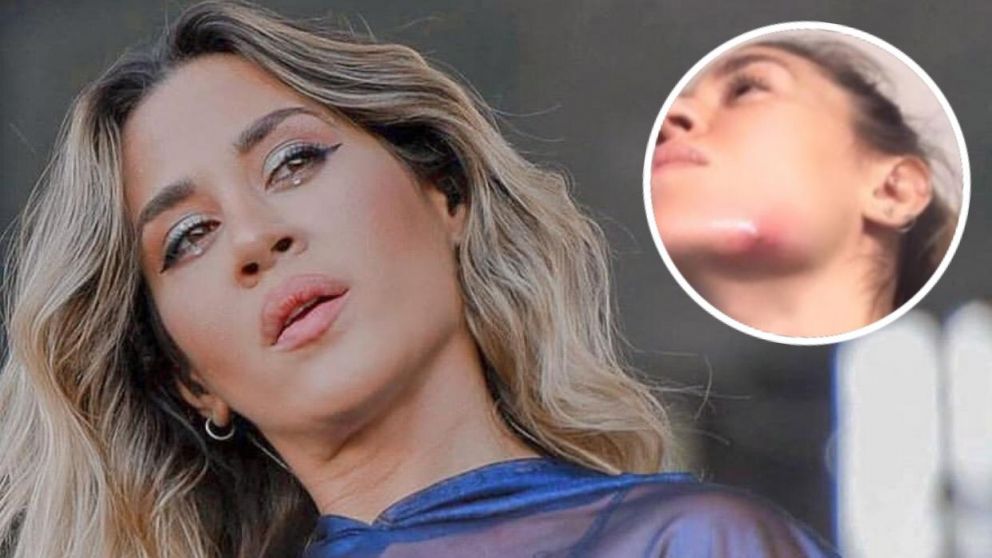 ¿Qué le pasa a la cantante?
