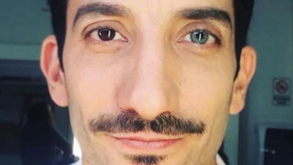 El actor debió ser intervenido por un quiste en su ojo derecho