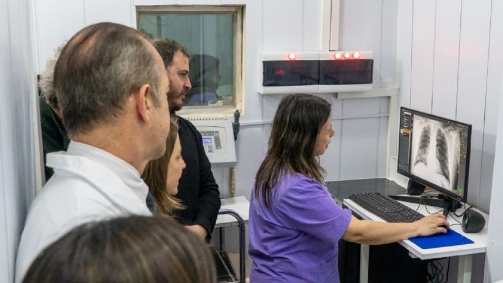 El Hospital Oller de Solano puso en marcha el nuevo sistema digital de Rayos: los detalles