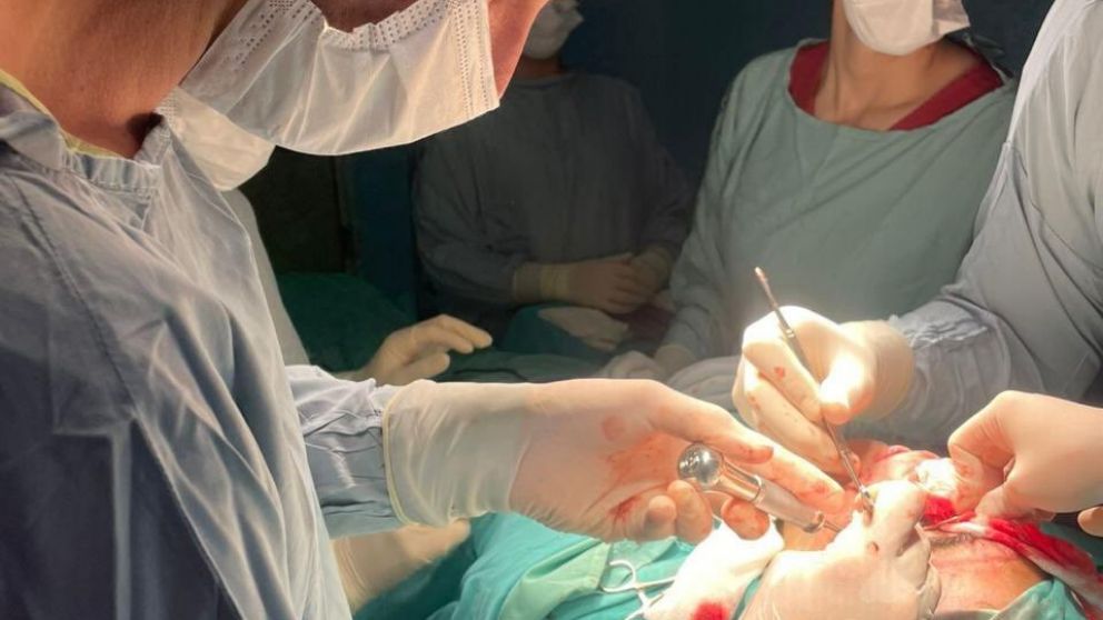 Hist�rico avance en el Hospital Iriarte: realizaron la primera cirug�a de reconstrucci�n facial de alta complejidad