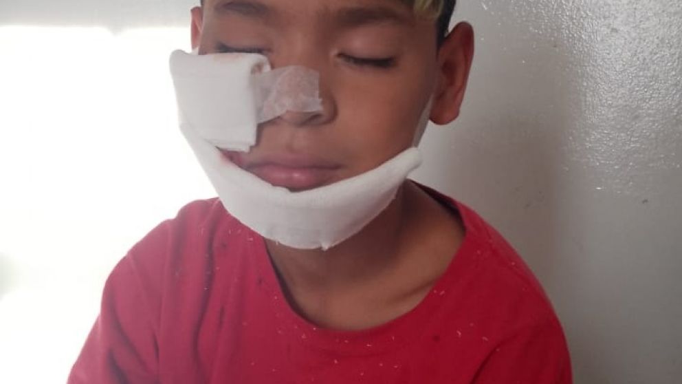 Quilmes: cómo está el nene que fue baleado por un policía