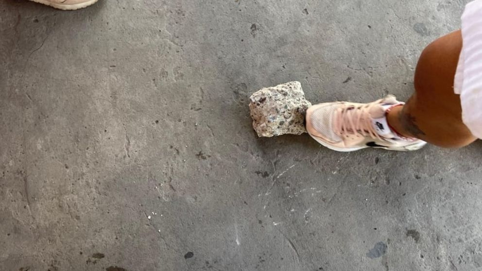 Tras el piedrazo en la cabeza: c�mo es el estado de salud de la peque�a brutalmente agredida en un colectivo