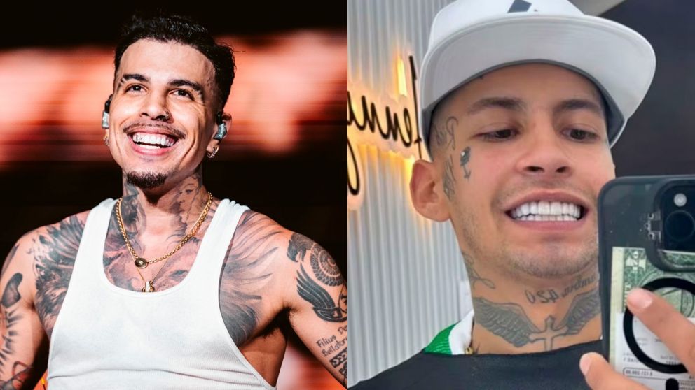 L-Gante y Rauw Alejandro: el antes y después de sus sonrisas con impresionantes arreglos de diamantes y joyas