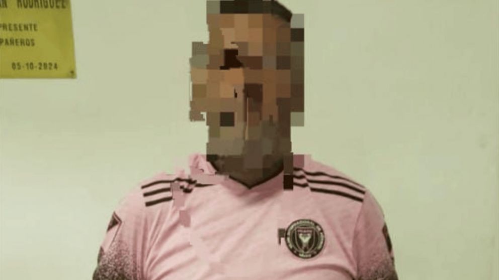 El acusado qued� tras las rejas por el delito de "lesiones leves".